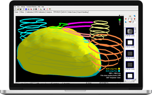 RAy™ Film Dosimetry Software